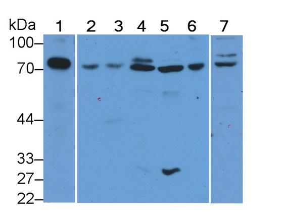 Polyclonal Antibody to Transferrin (TF)