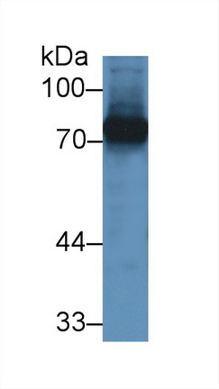 Polyclonal Antibody to Transferrin (TF)