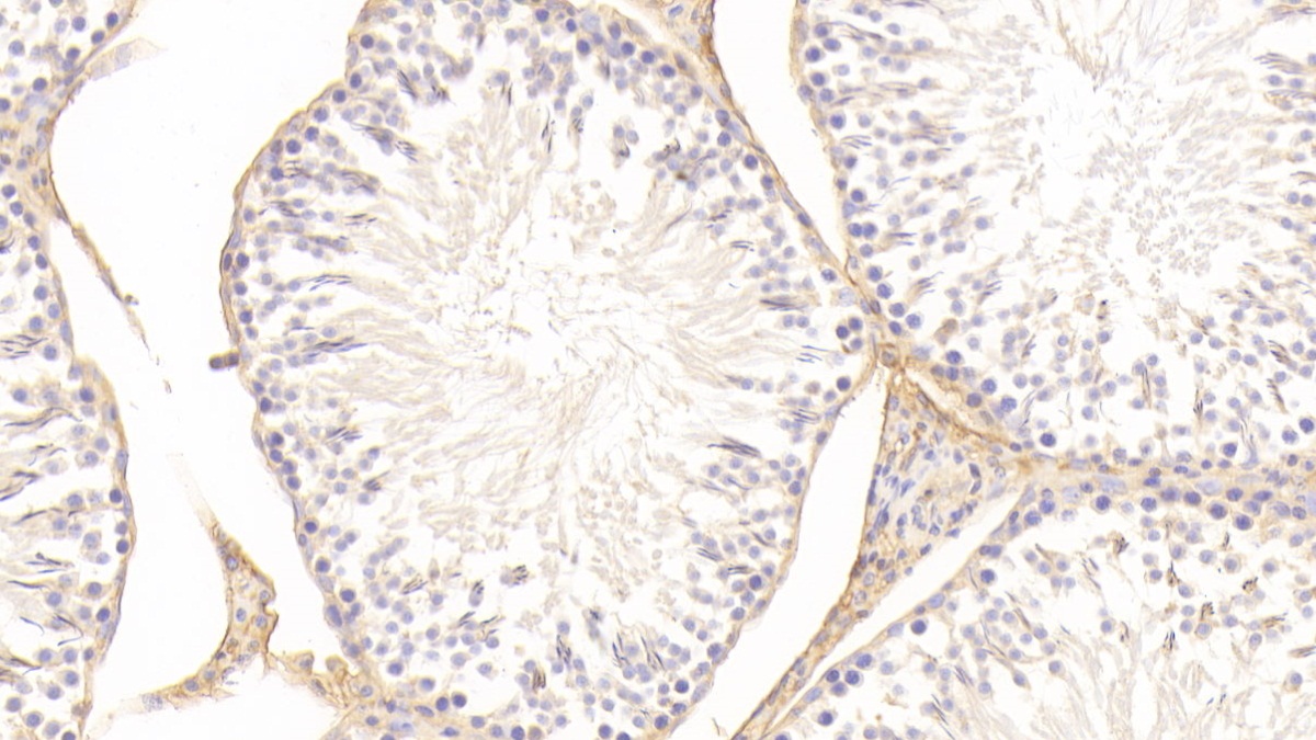 Polyclonal Antibody to Transferrin (TF)