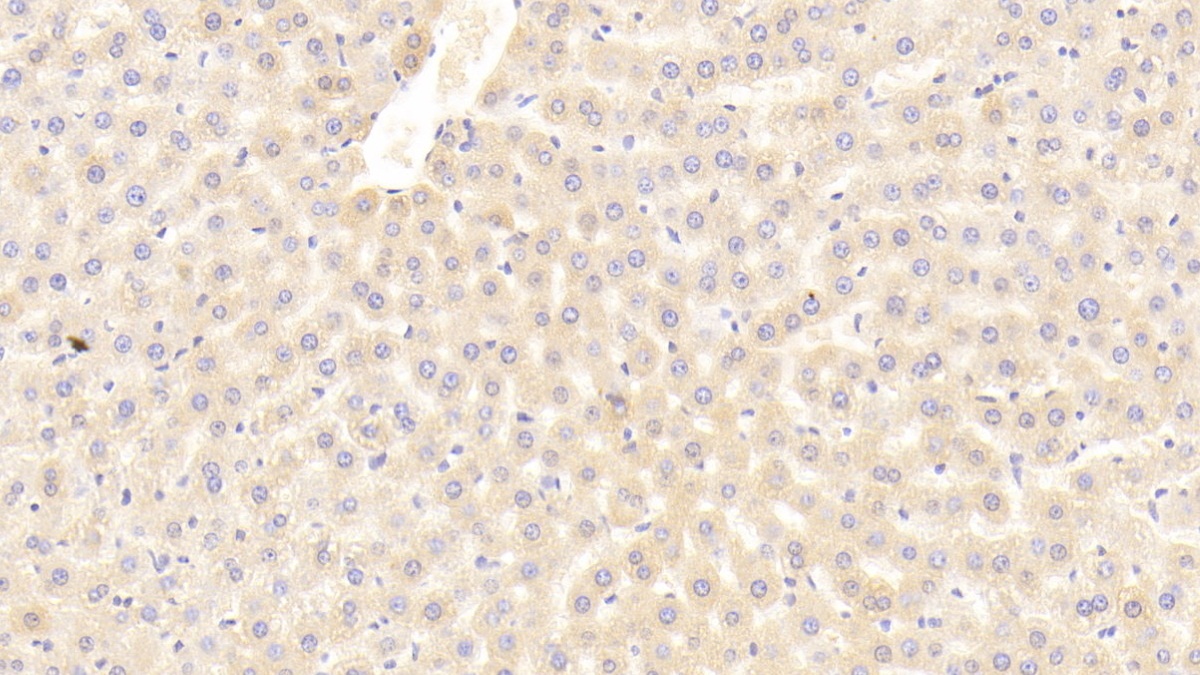 Polyclonal Antibody to Transferrin (TF)