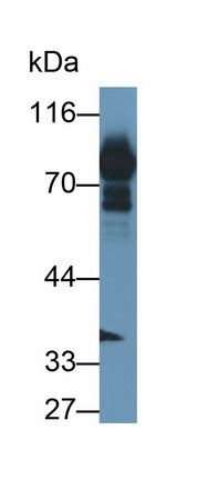 Polyclonal Antibody to Transferrin (TF)