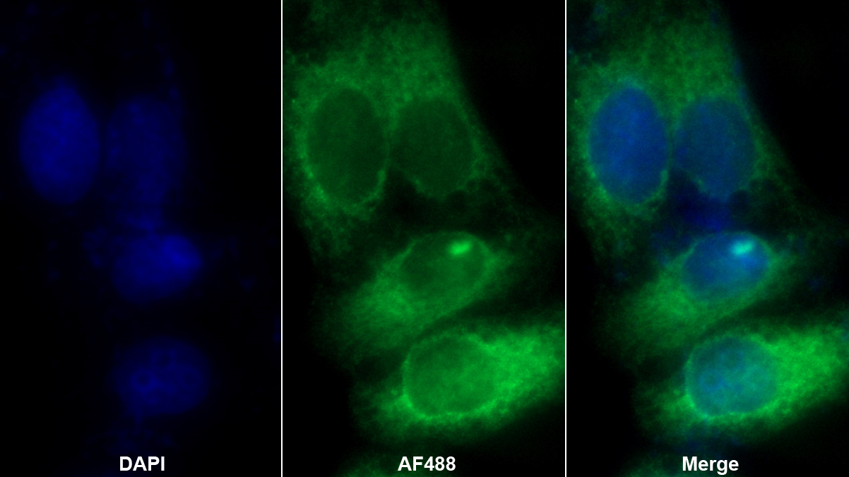 Polyclonal Antibody to Transferrin (TF)