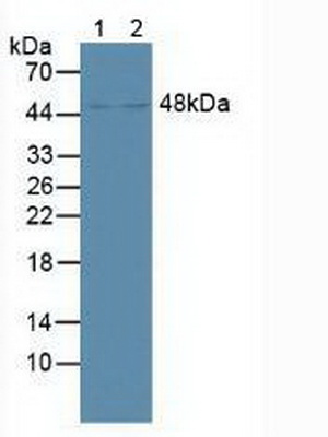 Polyclonal Antibody to Farnesoid X Receptor (FXR)