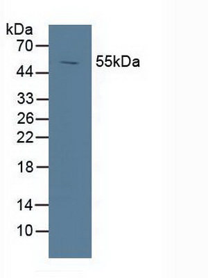 Polyclonal Antibody to Liver X Receptor Alpha (LXRa)