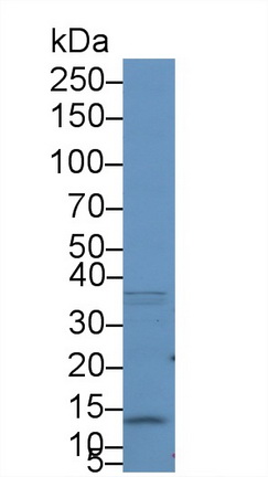 Polyclonal Antibody to S100 Calcium Binding Protein A10 (S100A10)