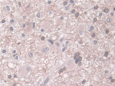 Polyclonal Antibody to Phospholipase D (PLD)