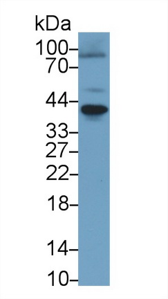 Polyclonal Antibody to Receptor Activator Of Nuclear Factor Kappa B (RANk)