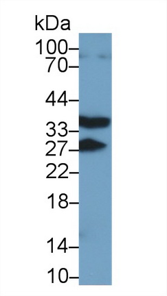 Polyclonal Antibody to Receptor Activator Of Nuclear Factor Kappa B (RANk)