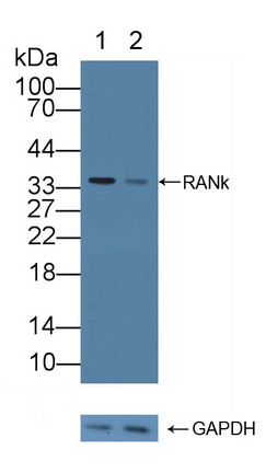 Polyclonal Antibody to Receptor Activator Of Nuclear Factor Kappa B (RANk)