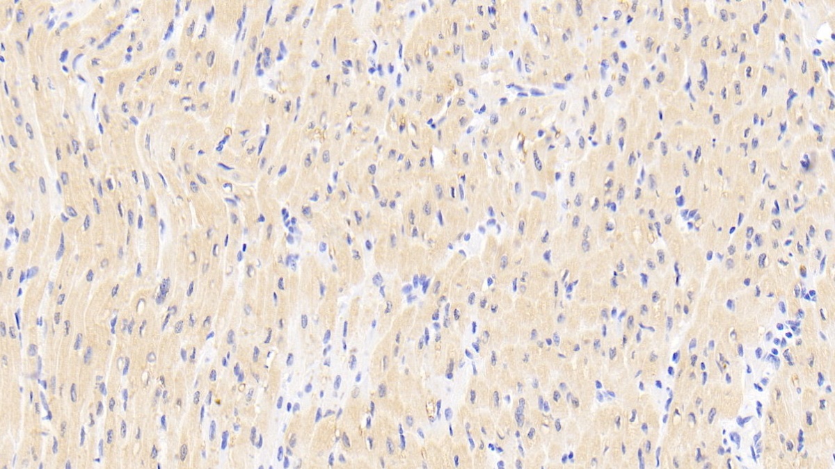 Polyclonal Antibody to Receptor Activator Of Nuclear Factor Kappa B (RANk)