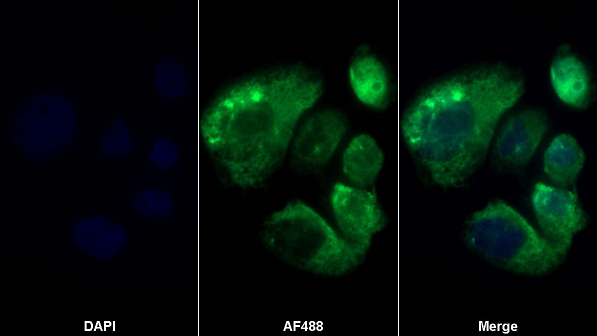 Polyclonal Antibody to Receptor Activator Of Nuclear Factor Kappa B (RANk)