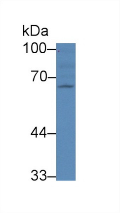 Polyclonal Antibody to Receptor Activator Of Nuclear Factor Kappa B (RANk)