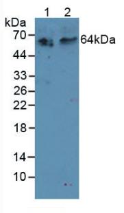 Polyclonal Antibody to Receptor Activator Of Nuclear Factor Kappa B (RANk)