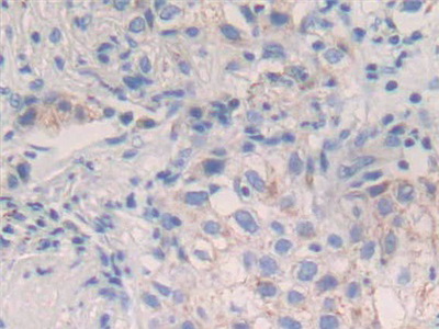 Polyclonal Antibody to Interleukin 20 (IL20)