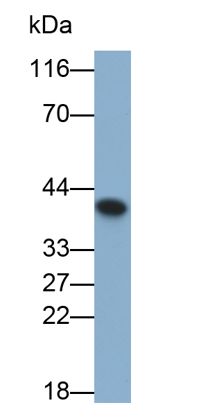 Polyclonal Antibody to Cyclin Dependent Kinase 6 (CDK6)