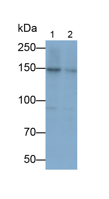 Polyclonal Antibody to Platelet Derived Growth Factor Receptor Alpha (PDGFRa)