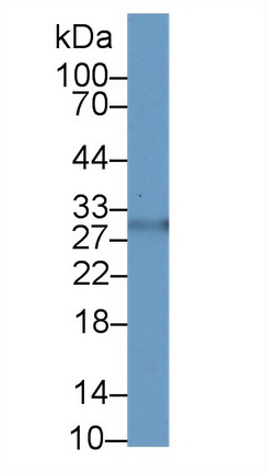 Polyclonal Antibody to Asialoglycoprotein Receptor 2 (ASGR2)