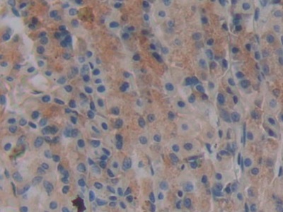 Polyclonal Antibody to Laminin Gamma 1 (LAMC1)