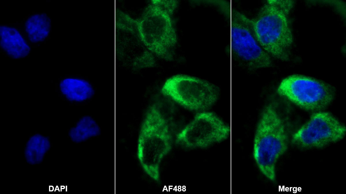 Polyclonal Antibody to Laminin Gamma 2 (LAMC2)