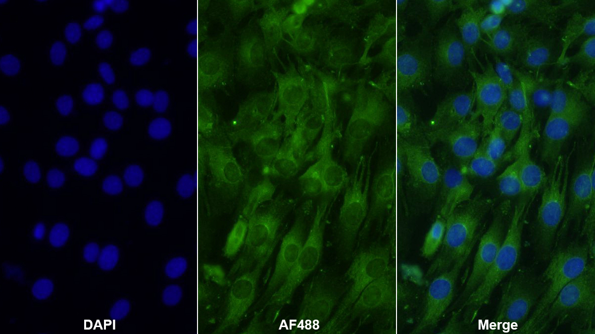 Polyclonal Antibody to Laminin Gamma 3 (LAMC3)