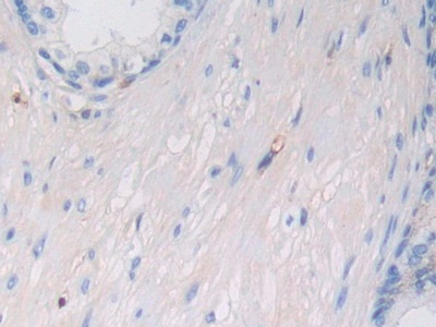 Polyclonal Antibody to Major Histocompatibility Complex Class I C (MHCC)