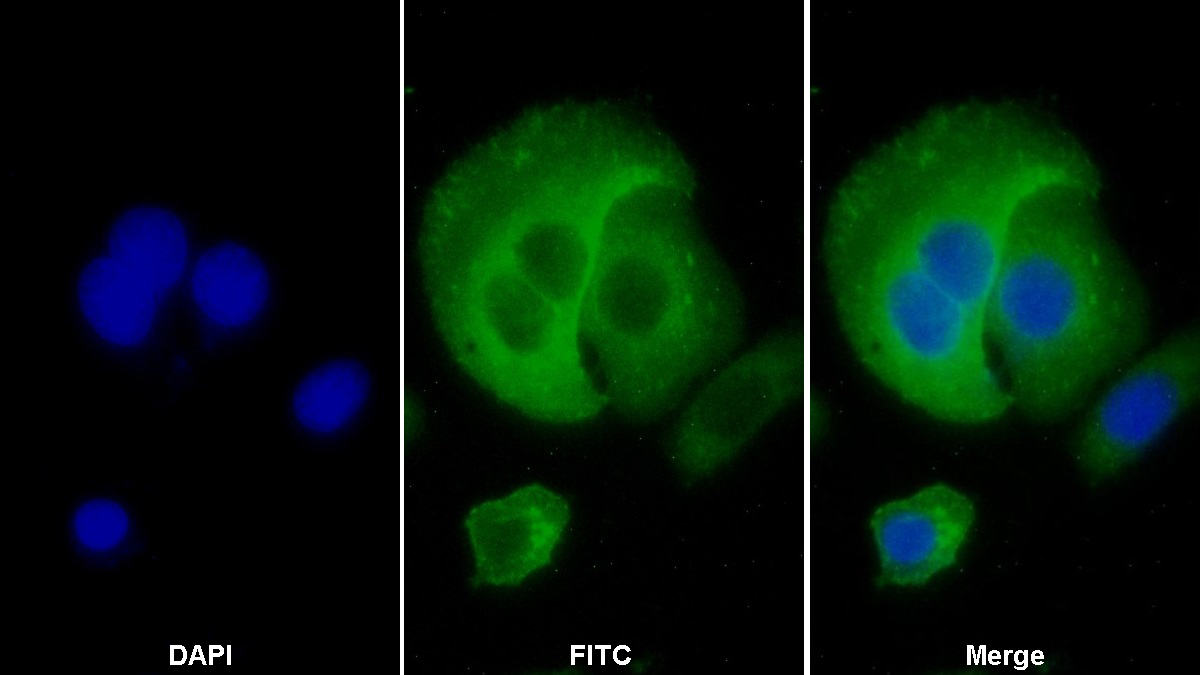 Polyclonal Antibody to Major Histocompatibility Complex Class I C (MHCC)