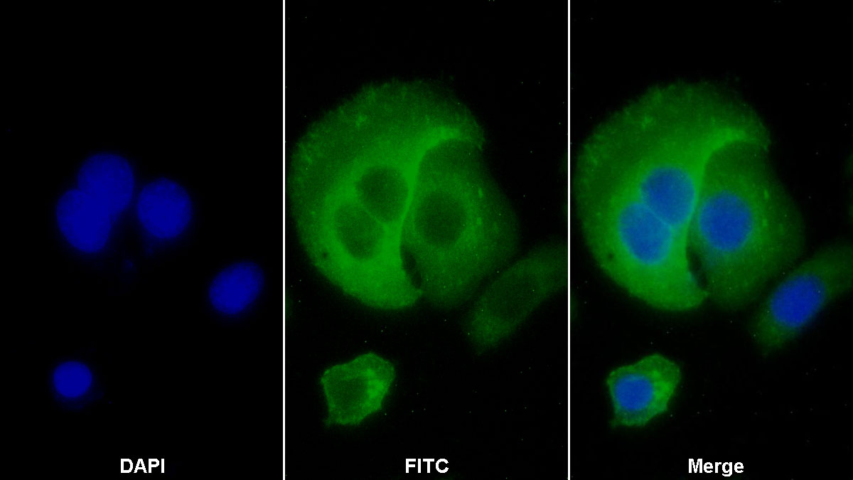 Polyclonal Antibody to Major Histocompatibility Complex Class I C (MHCC)