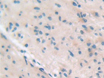 Polyclonal Antibody to Integrin Beta 5 (ITGb5)