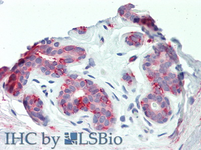 Polyclonal Antibody to Integrin Beta 6 (ITGb6)