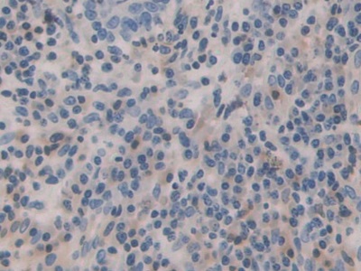 Polyclonal Antibody to Bone Morphogenetic Protein 15 (BMP15)