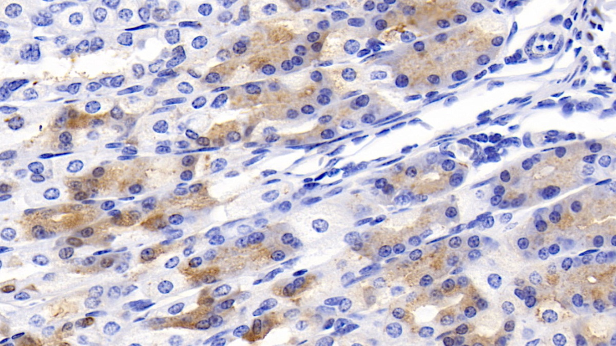 Polyclonal Antibody to Growth Differentiation Factor 1 (GDF1)