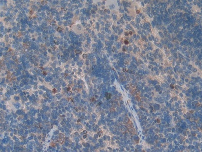 Polyclonal Antibody to Growth Differentiation Factor 3 (GDF3)