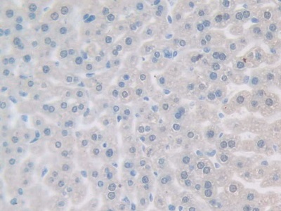 Polyclonal Antibody to Growth Differentiation Factor 5 (GDF5)