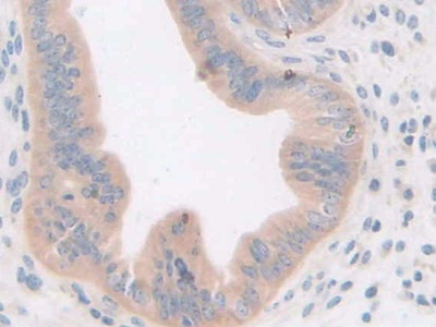 Polyclonal Antibody to Growth Differentiation Factor 5 (GDF5)