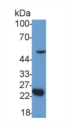 Polyclonal Antibody to Growth Differentiation Factor 11 (GDF11)