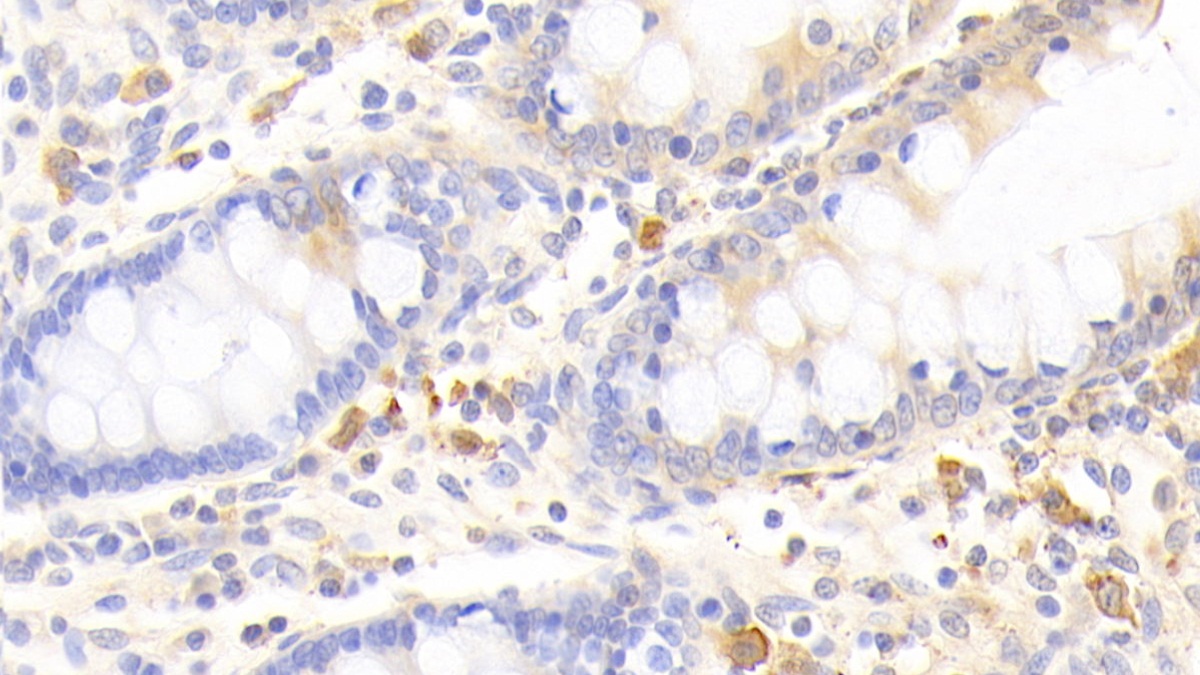 Polyclonal Antibody to Activin A Receptor Type I C (ACVR1C)