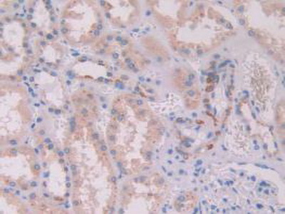 Polyclonal Antibody to Activin A Receptor Type II A (ACVR2A)