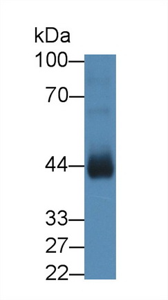 Polyclonal Antibody to Activin A Receptor Type II A (ACVR2A)