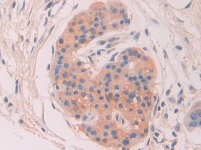 Polyclonal Antibody to Chordin (CHRD)