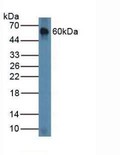 Polyclonal Antibody to Chordin (CHRD)