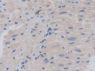 Polyclonal Antibody to Chordin (CHRD)