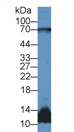 Polyclonal Antibody to Decorin (DCN)