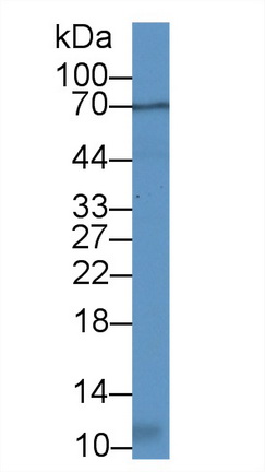 Polyclonal Antibody to Decorin (DCN)