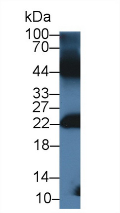 Polyclonal Antibody to Gremlin 1 (GREM1)