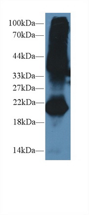 Polyclonal Antibody to Gremlin 1 (GREM1)