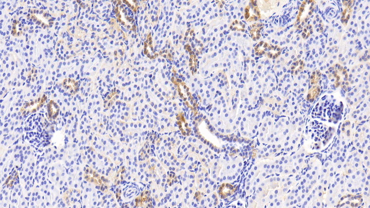 Polyclonal Antibody to Noggin (NOG)