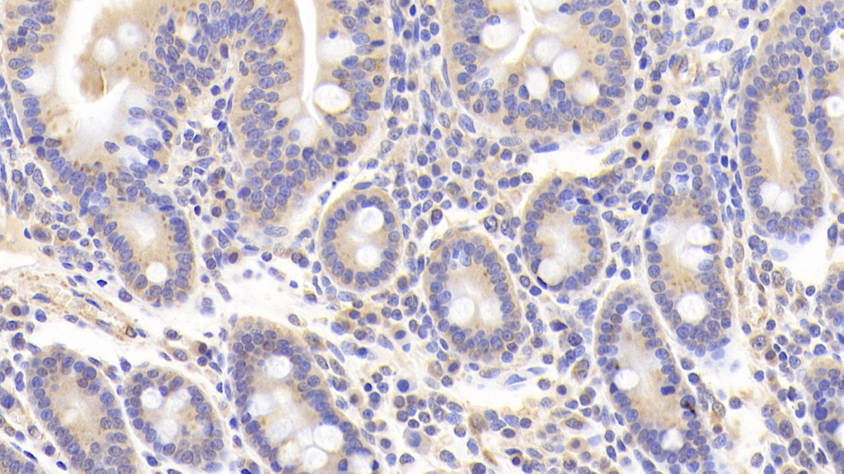 Polyclonal Antibody to Noggin (NOG)