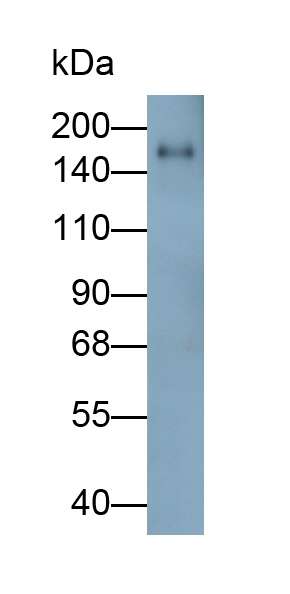 Polyclonal Antibody to Collagen Type XVII (COL17)