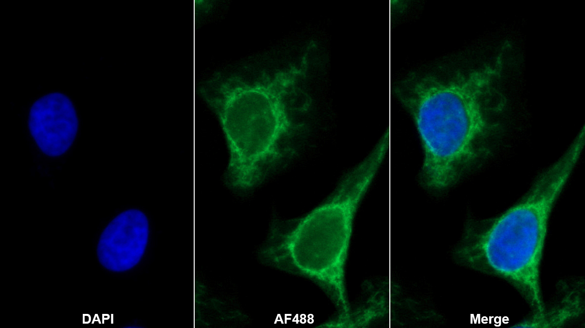 Polyclonal Antibody to Collagen Type XV (COL15)