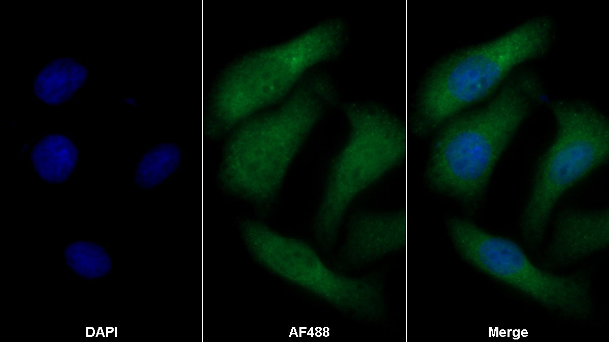 Polyclonal Antibody to Collagen Type IV Alpha 5 (COL4a5)